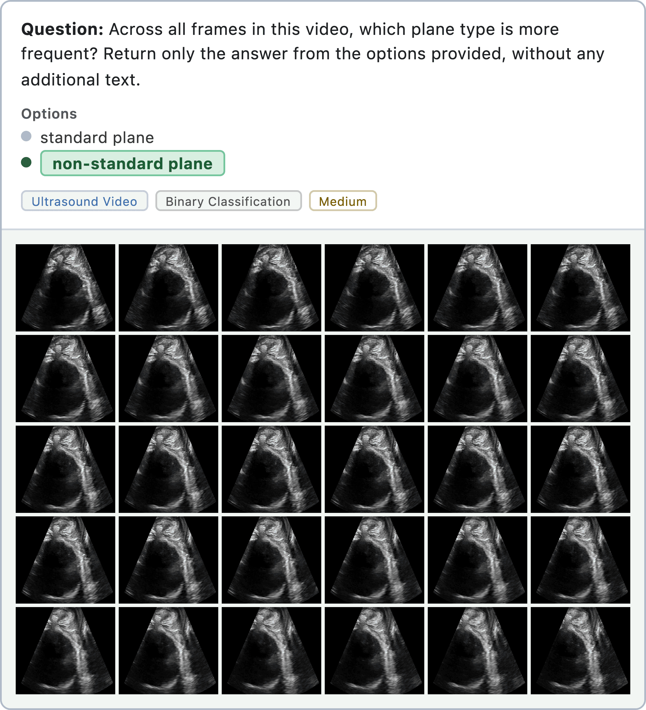 Figure 13: diagnostic visual question answering sample