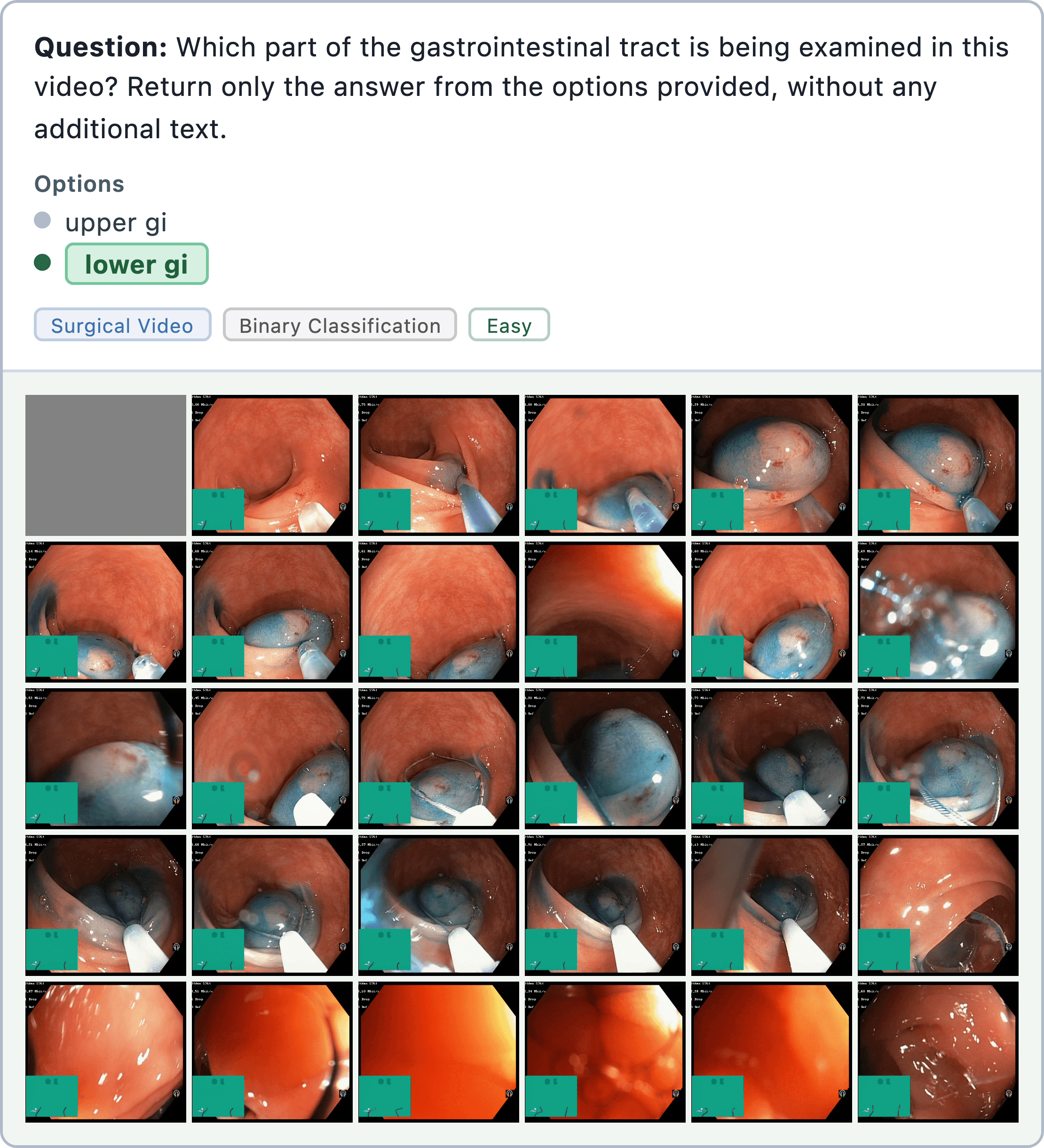 Figure 15: medical image localization sample