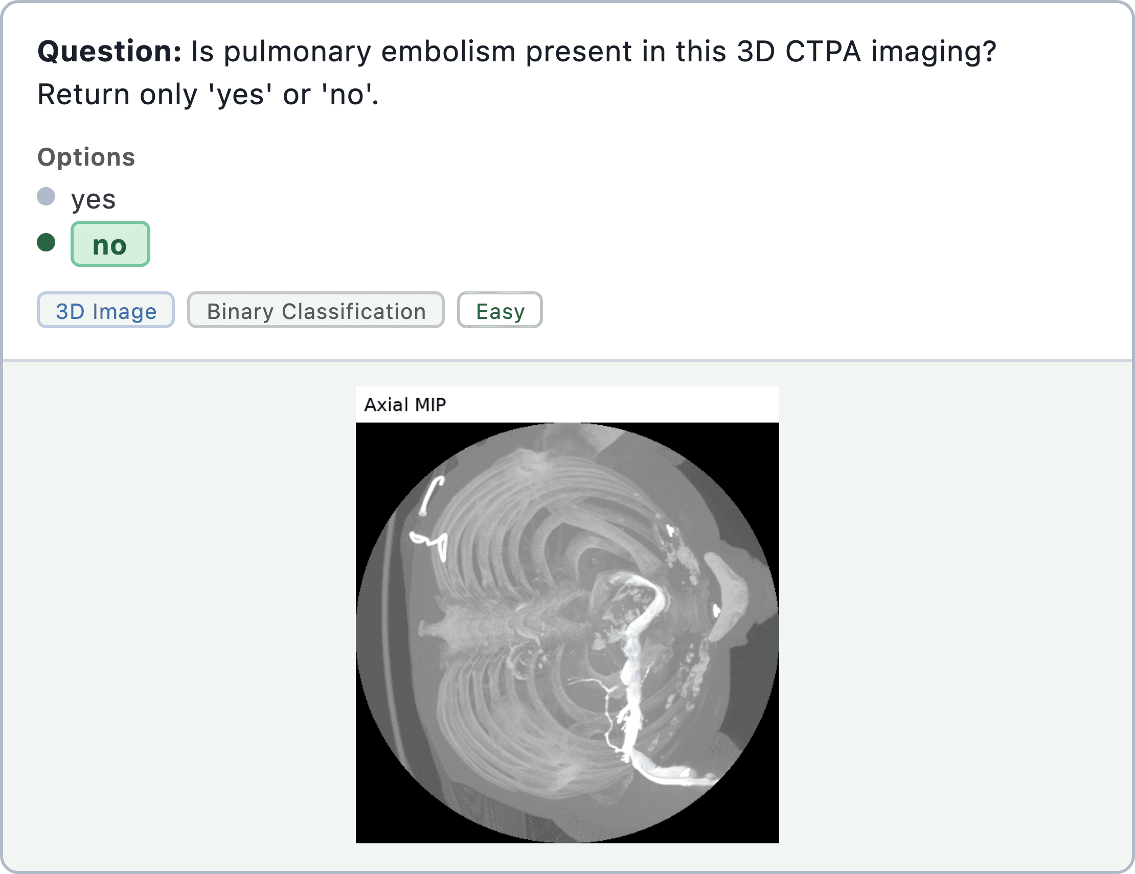 Figure 17: medical image recognition sample