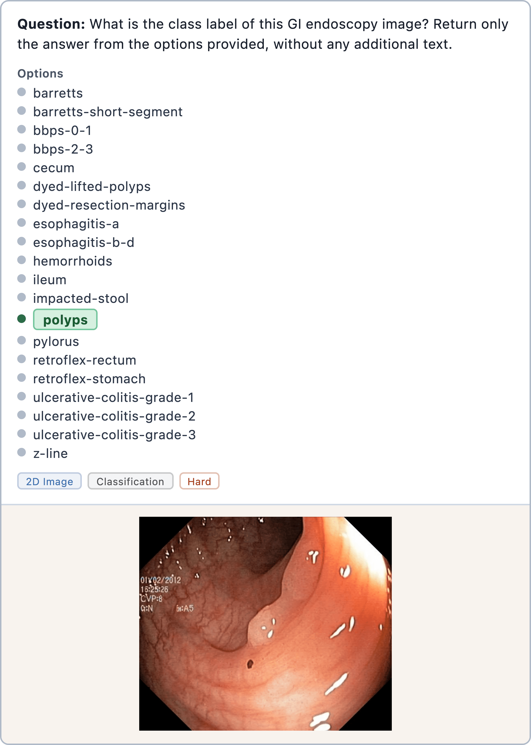 Figure 18: endoscopy image classification sample